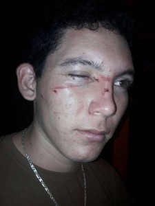 Así quedo el joven tras la agresión