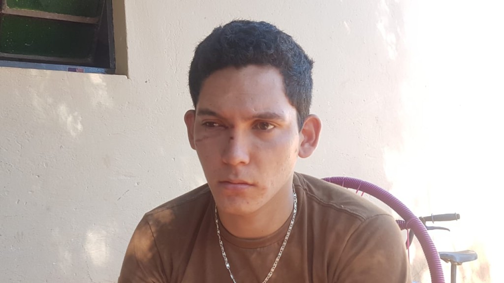 La victima presenta varios hematomas en el rostro