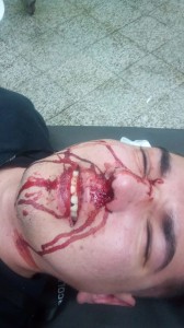 Tras el hecho fue auxiliado por sus familiares