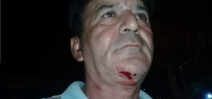 El hombre agredido