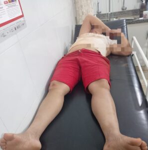 Mujer motociclista resulta herida tras caída en San Alfredo