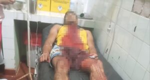 Imputan a joven por tentativa de feninicidio y piden prisión.